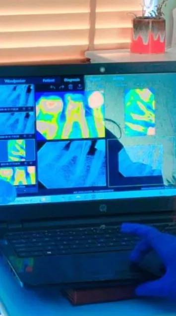 Digital dental X-ray images on a laptop at the chair