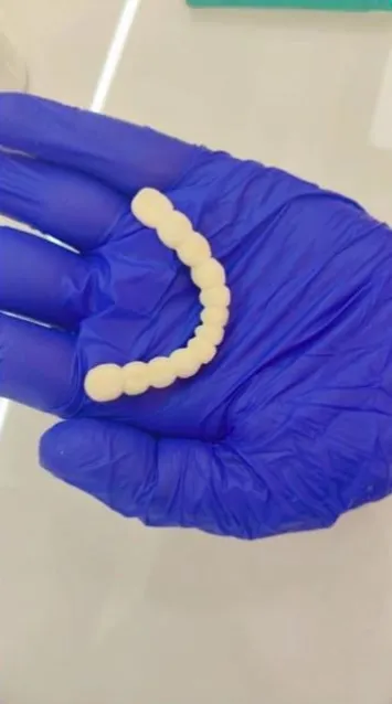 Ceramic full-arch bridge in a gloved hand